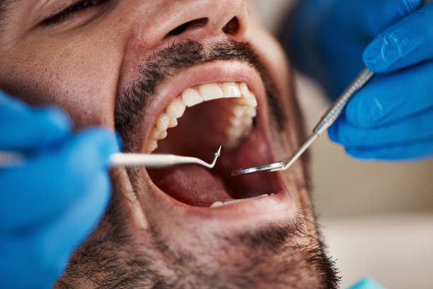 Best Emergency Dental Extractions in Goldthwaite, TX